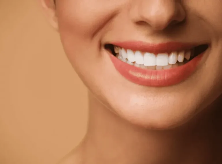 Achieving Natural Aesthetic Precision with Modern Dental Veneers