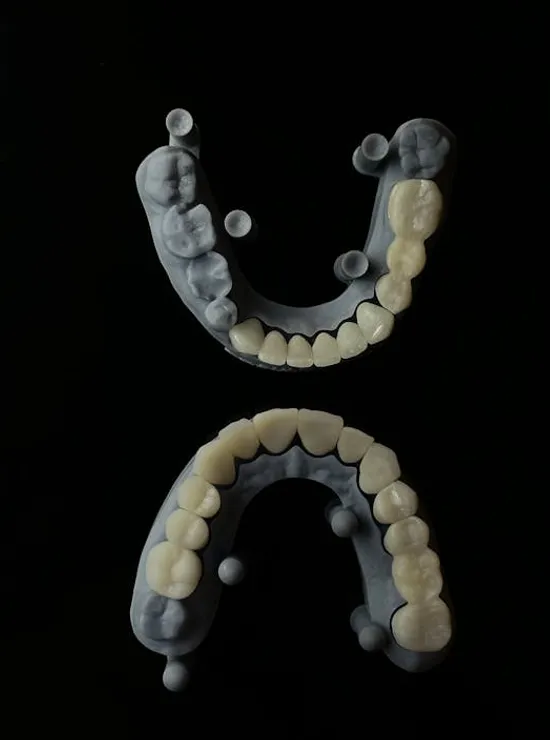 How the Best Orthodontist Plans Effective Smile Corrections